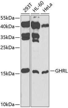 GHRL antibody[38229]