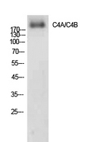 C4a/b Polyclonal Antibody[4190