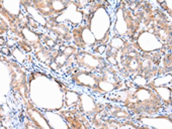 ACVRL1 Antibody[43246]