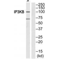 ITPKB Antibody[33734]