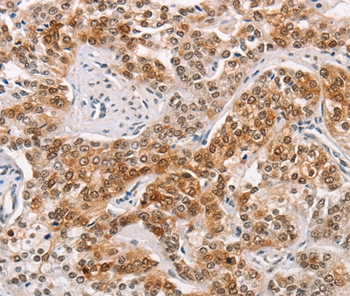 CABLES1 Antibody[36296]