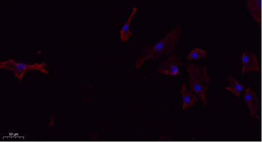 FUNDC1 Polyclonal Antibody[487
