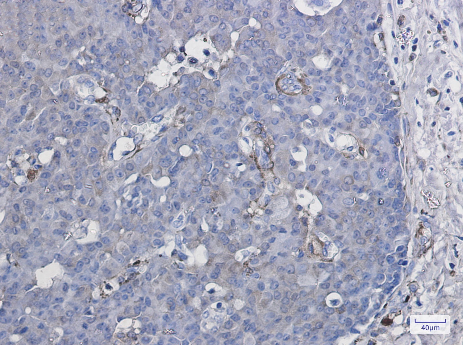 Cytochrome P450 1B1 Rabbit mAb