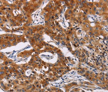 MSLN Antibody[35823]