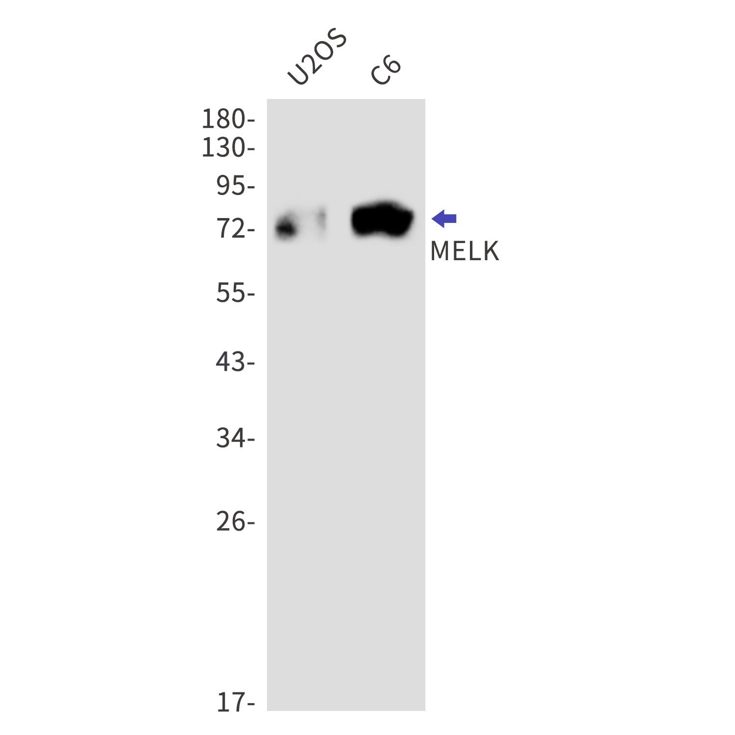 MELK Rabbit mAb[52802]
