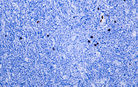 CD8 a mouse mAb(ABT155)[58251]