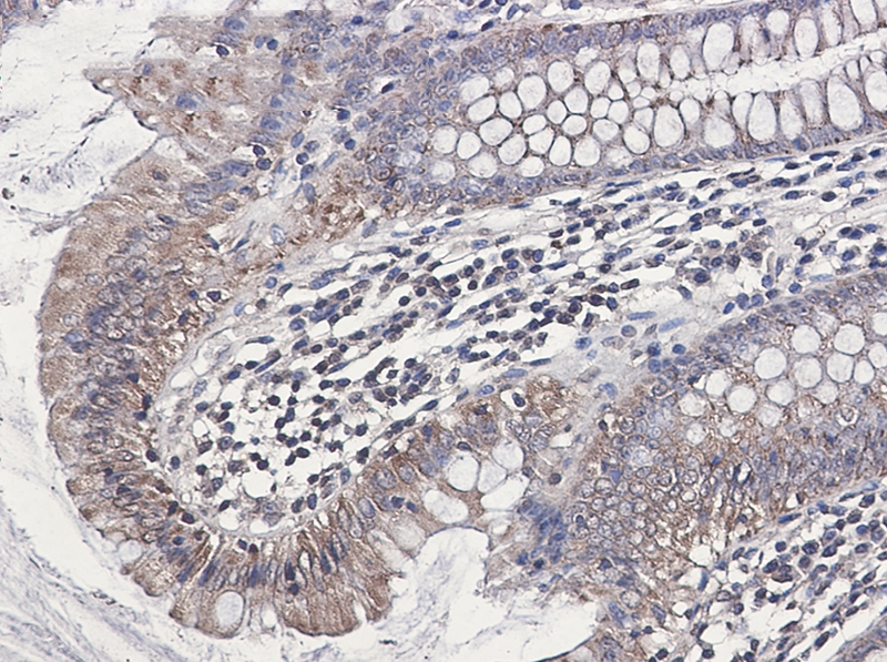 NDUFB1 Rabbit mAb[52675]