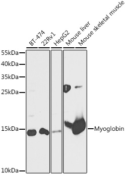 MB Rabbit Polyclonal Antibody[