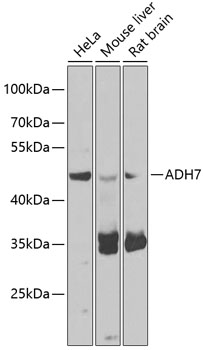 ADH7 Rabbit Polyclonal Antibod