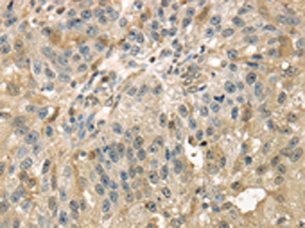 RAB17 Antibody[43393]