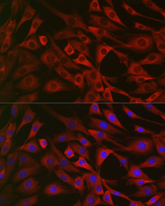 IRS2 Rabbit Polyclonal Antibod