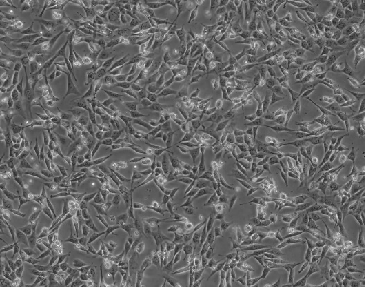细胞攻略 | HT-22(小鼠海马神经元细胞)培养教程