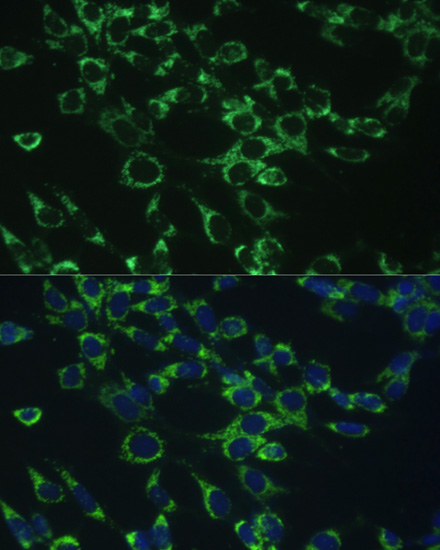 COX5B Rabbit Polyclonal Antibo