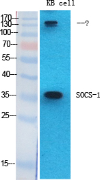 SOCS-1 Polyclonal Antibody[414