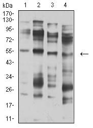 CHRNA5 Mouse mAb[63472]