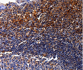 IL10RA Antibody[35598]