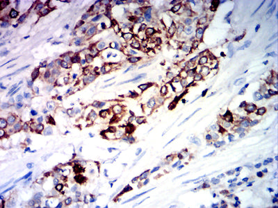 KCNK1 Mouse mAb[63810]