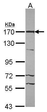 ASPP2 Antibody[35393]