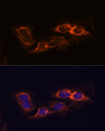 RIPK3 antibody[38654]