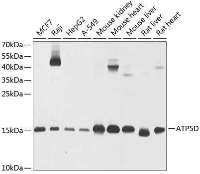 ATP5D Rabbit Polyclonal Antibo
