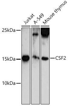 CSF2 Rabbit Polyclonal Antibod