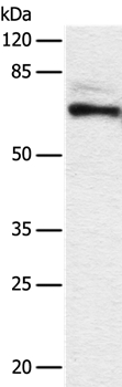 DPYSL2 Antibody[36804]
