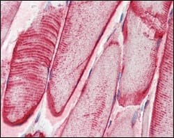 CRYAB Mouse mAb[63508]