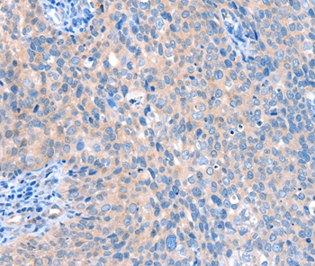 ACOX1 Antibody[36021]