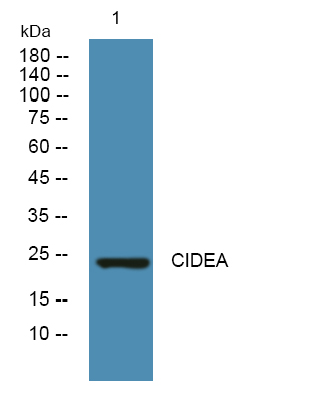 CIDEA Polyclonal Antibody[4889