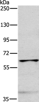 MYLK2 Antibody[35816]