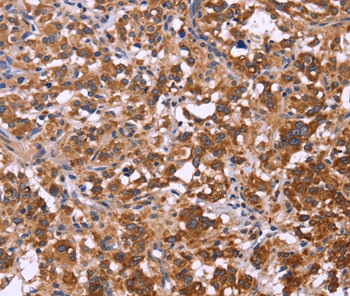 FBXW7 Antibody[36334]