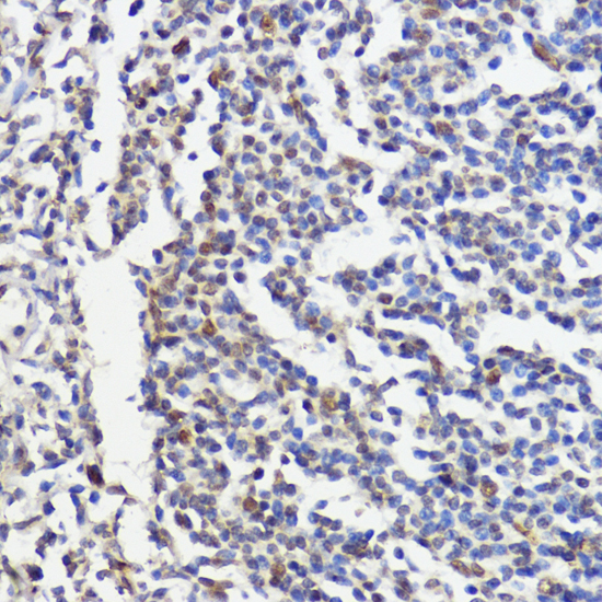 pan-AKT antibody[38602]
