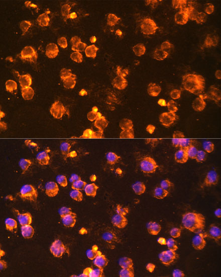 FYN Rabbit Polyclonal Antibody