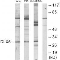 DLX5 Antibody[33825]