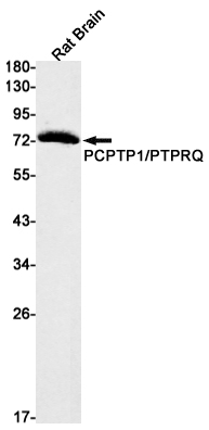 PCPTP1 Rabbit mAb[52490]
