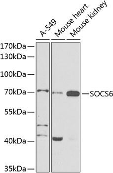 SOCS6 Rabbit Polyclonal Antibo