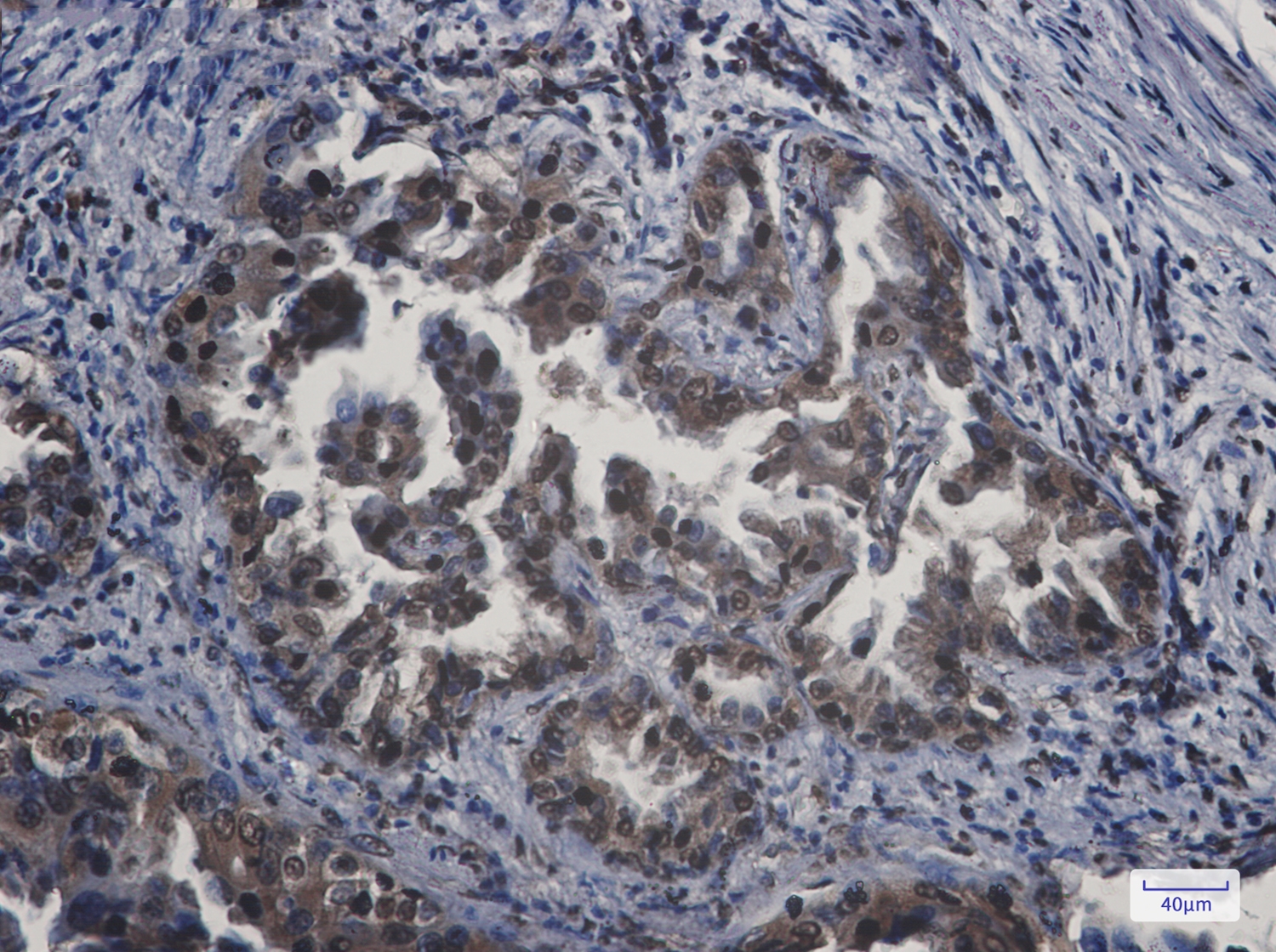 APPL Rabbit mAb[52152]