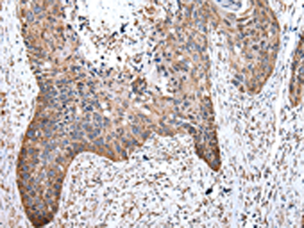 WASL Antibody[43021]