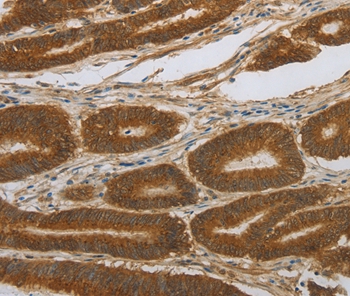 NOTCH4 Antibody[37195]