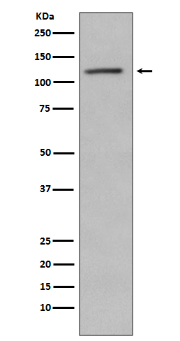 Retinoblastoma (Phospho-Ser780