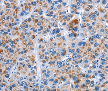 CENPJ Antibody[36343]