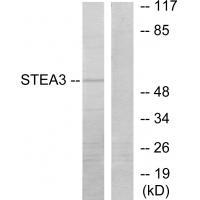 STEA3 Antibody[33932]