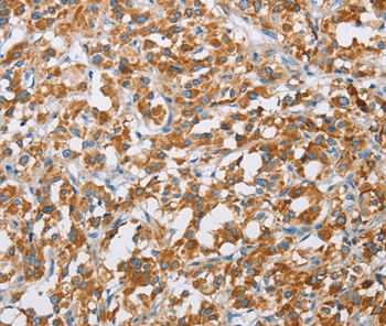 BDH1 Antibody[36279]