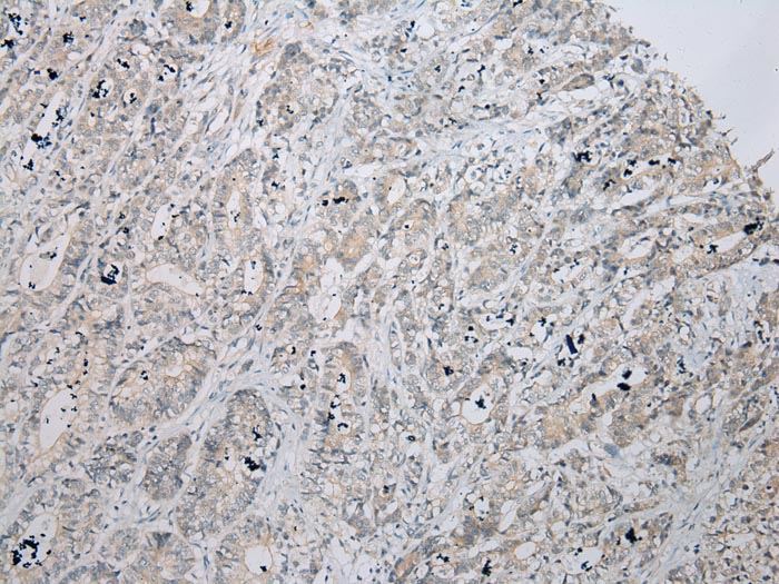 ZNF621 Antibody[43363]