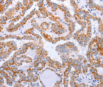 DTX2 Antibody[35711]