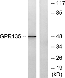 GPR135 Polyclonal Antibody[442