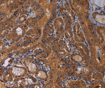 MAGEB10 Antibody[36596]