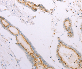 ADAM28 Antibody[37311]