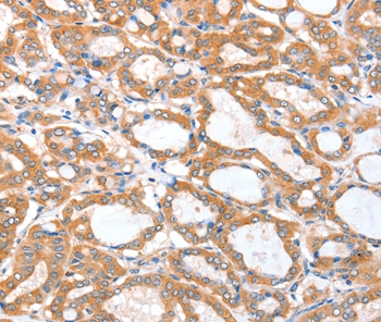 ACSBG1 Antibody[36024]
