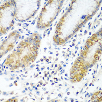 ATAD3A Rabbit Polyclonal Antib